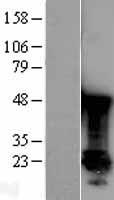 PARK7 Human Over-expression Lysates NM_001123377
