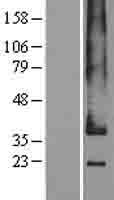 GPR182 Human Over-expression Lysates NM_007264