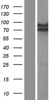 SGT1 (ECD) Human Over-expression Lysates NM_001135752