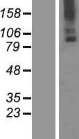 ls011322 tmc6 human over expression lysates nm 001127198 wb testing 1