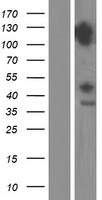 DDX42 Human Over-expression Lysates NM_203499