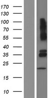 VSIG4 Human Over-expression Lysates NM_001100431