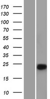 Chymotrypsin (CTRC) Human Over-expression Lysates NM_007272