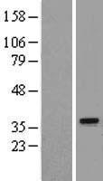 REA (PHB2) Human Over-expression Lysates NM_001144831