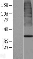 ls011332 acot7 human over expression lysates nm 181866 wb testing 1