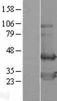 TWF2 Human Over-expression Lysates NM_007284