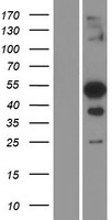 TFEC Human Over-expression Lysates NM_001018058