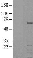 IKZF3 Human Over-expression Lysates NM_012481
