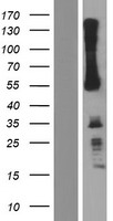 IKZF3 Human Over-expression Lysates NM_183228