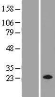 ls022808 mras human over expression lysates nm 012219 wb testing 1