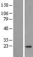 COPZ1 Human Over-expression Lysates NM_016057