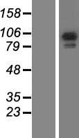 RASA3 Human Over-expression Lysates NM_007368