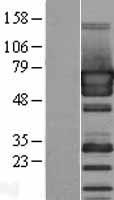 PUF60 Human Over-expression Lysates NM_014281