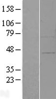 ZFP30 Human Over-expression Lysates NM_014898