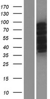 ls022849 cpeb3 human over expression lysates nm 001178137 wb testing 1