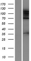 ADNP homeobox protein 2 (ADNP2) Human Over-expression Lysates NM_014913