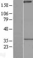 NALP1 (NLRP1) Human Over-expression Lysates NM_033004
