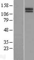 SLITRK3 Human Over-expression Lysates NM_014926