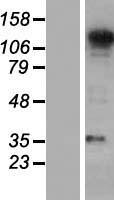 ls022872 sec31a human over expression lysates nm 001077208 wb testing 1