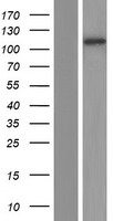 MLX interacting protein (MLXIP) Human Over-expression Lysates NM_014938