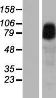 ANKRD6 Human Over-expression Lysates NM_014942