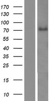 ABLIM3 Human Over-expression Lysates NM_014945