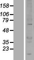 ls022888 ubox5 human over expression lysates nm 014948 wb testing 1