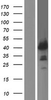 ZNF365 Human Over-expression Lysates NM_199450