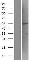 ZNF365 Human Over-expression Lysates NM_199451