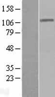 DIS3 Human Over-expression Lysates NM_014953