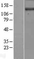 ls022898 dennd3 human over expression lysates nm 014957 wb testing 1