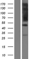RIPX (RUFY3) Human Over-expression Lysates NM_014961