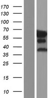 Epsin 2 (EPN2) Human Over-expression Lysates NM_001102664