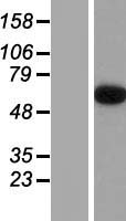Epsin 2 (EPN2) Human Over-expression Lysates NM_148921