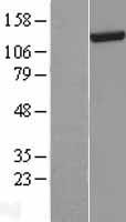 DHX30 Human Over-expression Lysates NM_014966