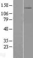 DHX30 Human Over-expression Lysates NM_138615