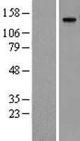 MMRN1 Human Over-expression Lysates NM_007351