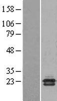 NCBP2 Human Over-expression Lysates NM_007362