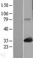 MAPRE1 Human Over-expression Lysates NM_012325