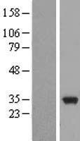 ls022924 eb3 mapre3 human over expression lysates nm 012326 wb testing 1