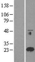 RAB18 Human Over-expression Lysates NM_021252