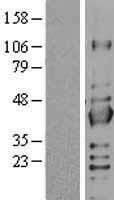 SIRT2 Human Over-expression Lysates NM_012237
