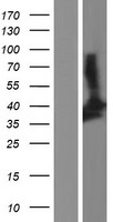 SIRT2 Human Over-expression Lysates NM_030593