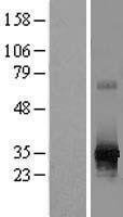 RPIA Human Over-expression Lysates NM_144563