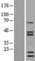 NCOA62 (SNW1) Human Over-expression Lysates NM_012245