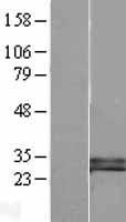 DKK1 Human Over-expression Lysates NM_012242