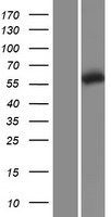 TCP1 epsilon (CCT5) Human Over-expression Lysates NM_012073