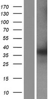 ls022949 ptgr1 human over expression lysates nm 001146109 wb testing 3