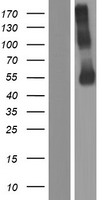 ls022953 p2x2 p2rx2 human over expression lysates nm 016318 wb testing 6