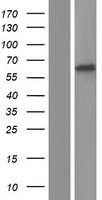 ls022953 p2x2 p2rx2 human over expression lysates nm 170683 wb testing 1